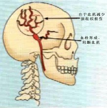 脑